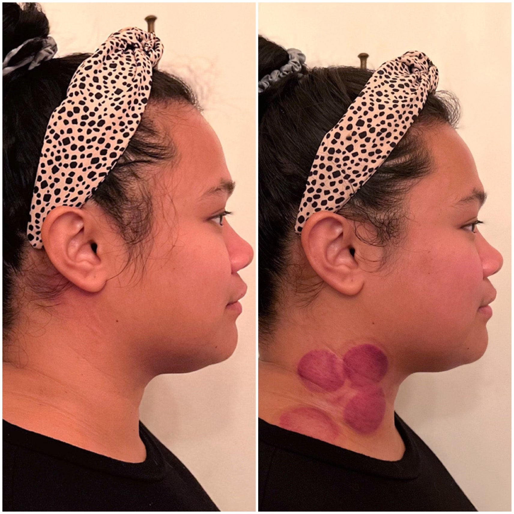 I Tried Facial Gua Sha From A Traditional Chinese Medicine Practitioner