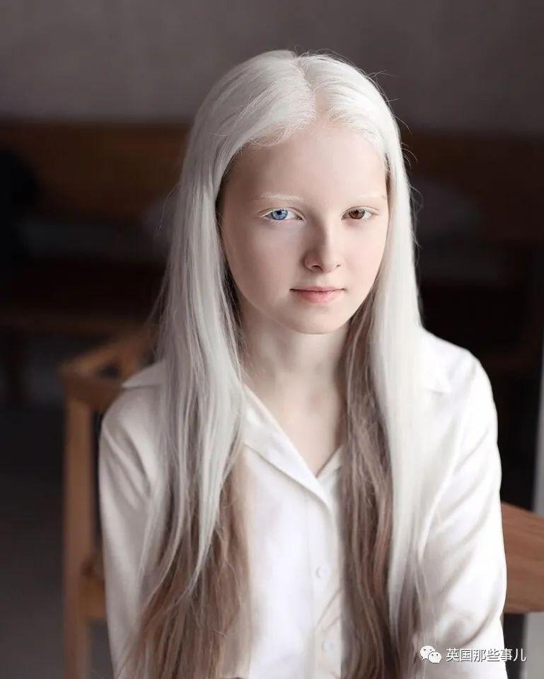 一眼冰雪 一眼森林 这个白化病 异色瞳的俄罗斯少女让网友震惊了 Nestia