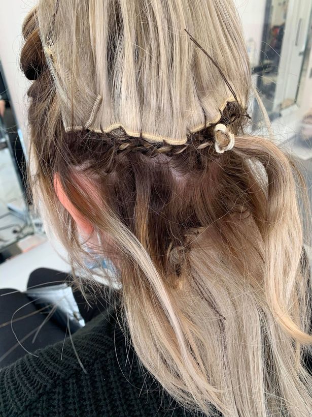 Mum with 'worst hairstyle of 2020' claims 'drunk' stylist left needle in  her scalp | Nestia
