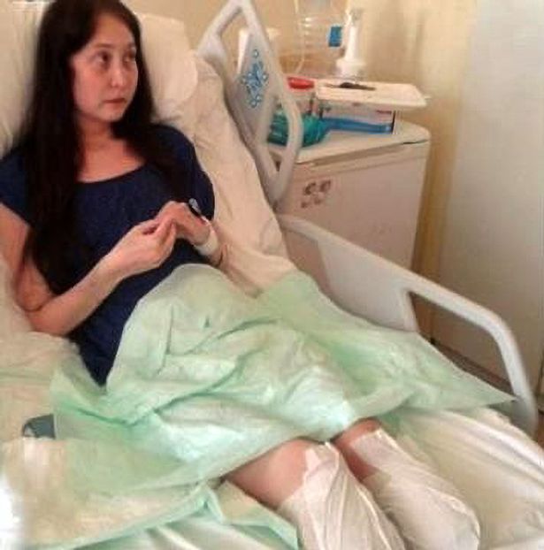 Woman Forced To Have Both Legs Amputated After Botched Nose Job In Turkey Nestia