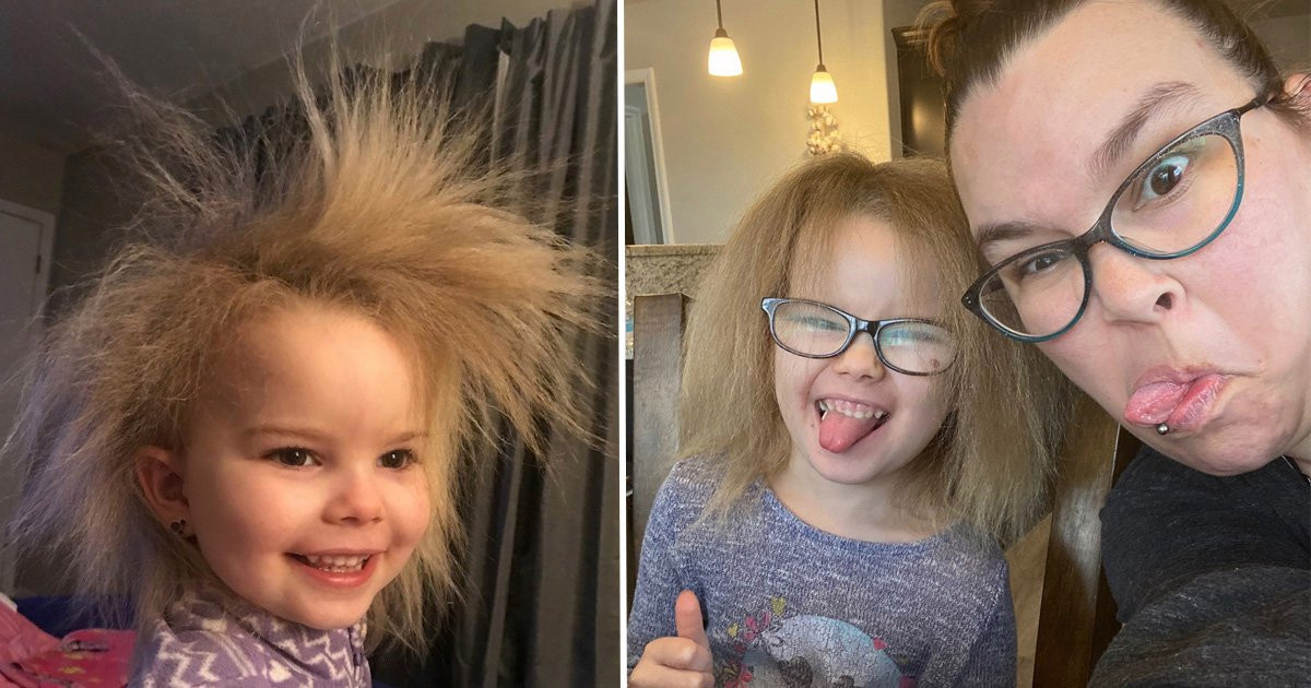 Five-year-old girl has rare uncombable hair syndrome that makes her look like she has constant bedhead | Nestia Five-year-old girl has rare uncombable hair syndrome that makes her look like she has constant bedhead | Nestia