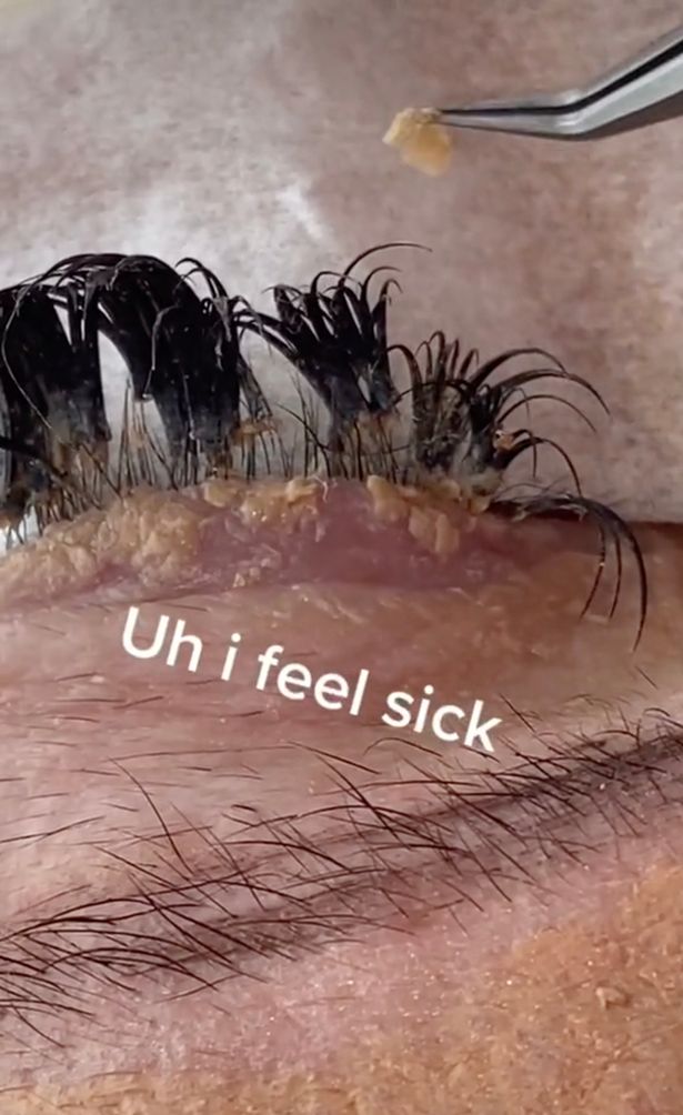 Beautician Shows Grim Consequence Of Not Cleaning Your Eyelash Extensions Nestia