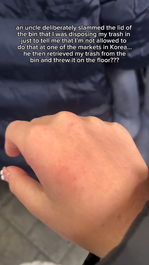 Man in korea slams bin lid on s’pore Tourist’s hand over wrong trash disposal Nestia